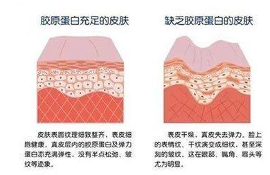 水解胶原蛋白是什么？水解胶原蛋白在护肤中的功效与作用